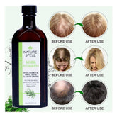 Rosemary Oil for Hair Growth-Items Online